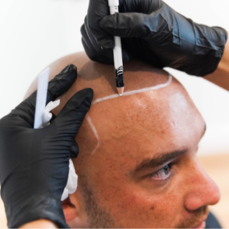 RPL - SHBBCOS007  - Provide Cosmetic Tattoo for Scalp Micropigmentation